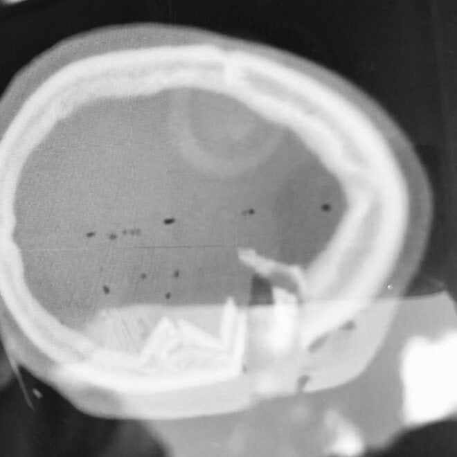 Then I saw the scan.